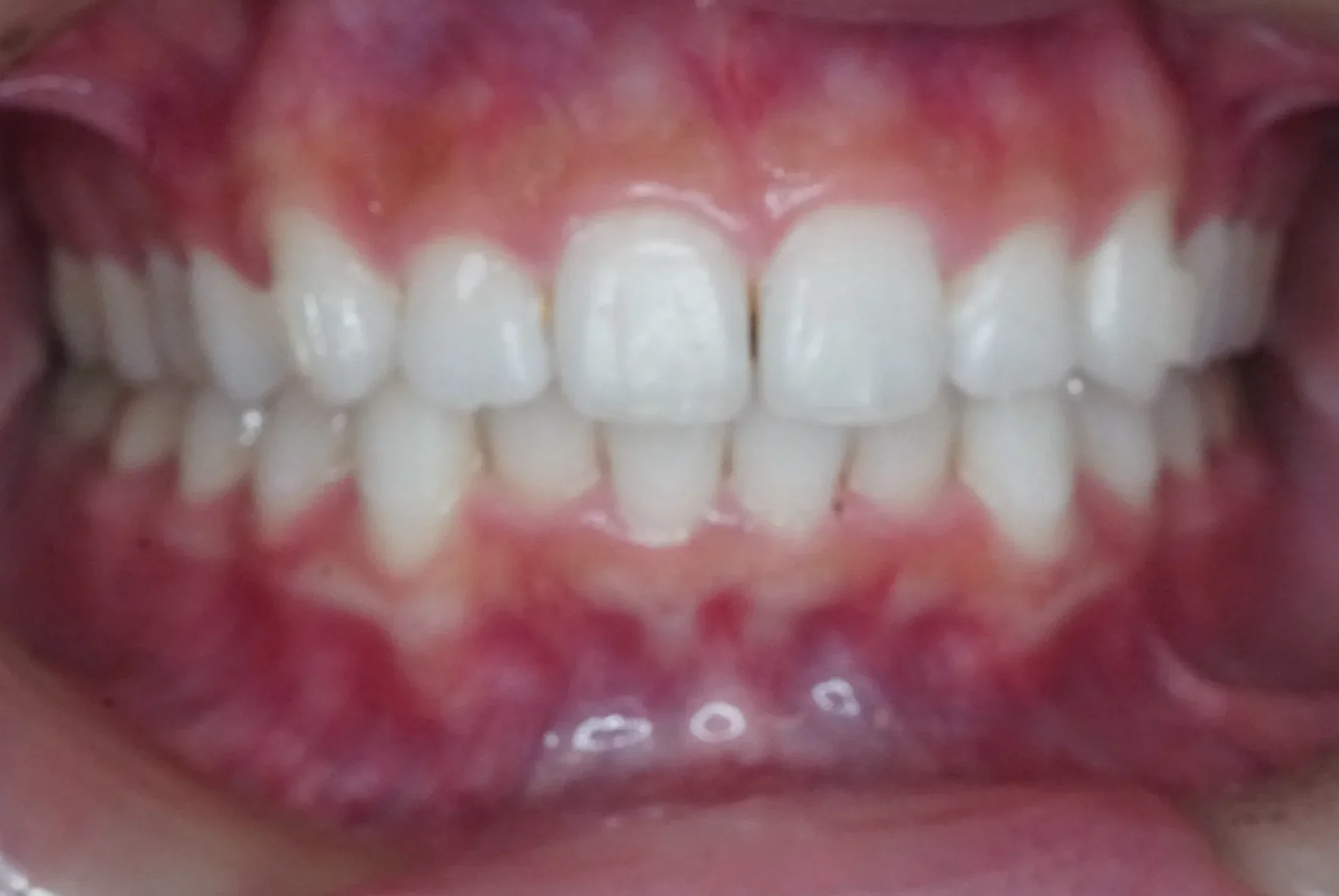 Before
